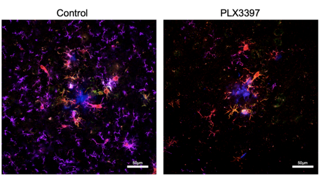UK doctors say breakthrough in Alzheimer’s research may have found way to restore sleep