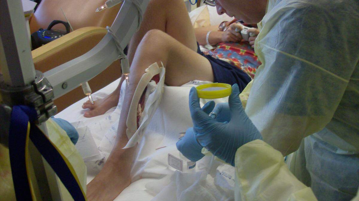 Dr. William O'Neill of Bluegrass Orthopaedics placed medical maggots into Dylan Newton's leg during a surgical procedure. The maggots helped keep Newton from having to undergo more surgeries by eating the dead tissue inside his leg.﻿