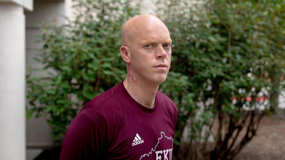 EKU’s A.W. Hamilton hopes he has beaten cancer. Now, he has a plan to save others.