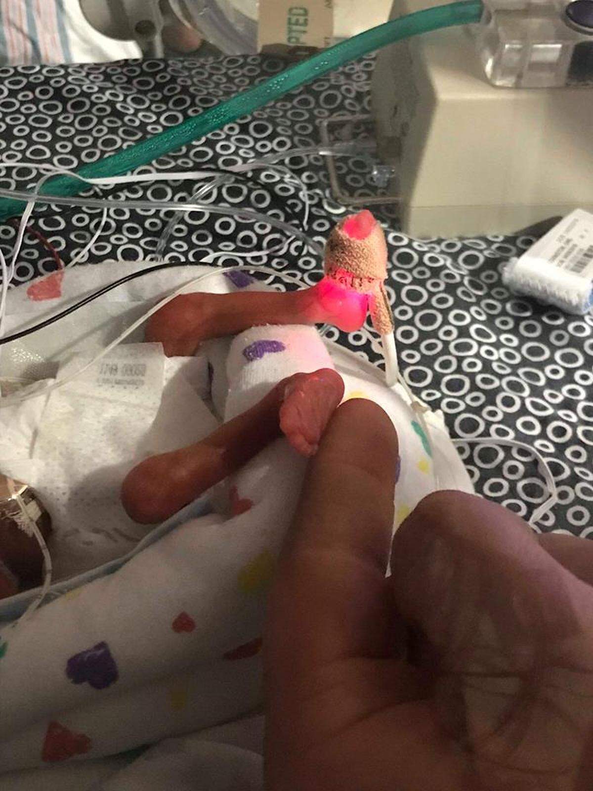 Kyndall Covington is the smallest surviving baby ever born at the University of Kentucky. She weighed just 12.6 ounces when she was born in April.