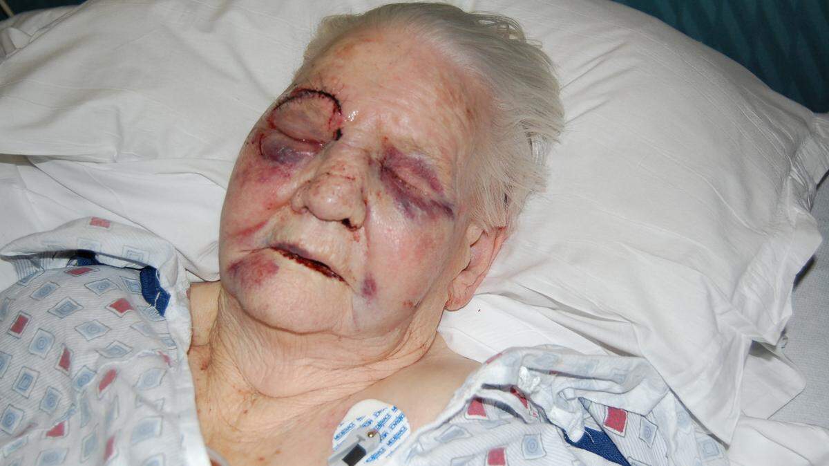 Irene Hendrix was injured on Jan. 21, 2009, while a resident of Cambridge Place Nursing Home in Lexington.
