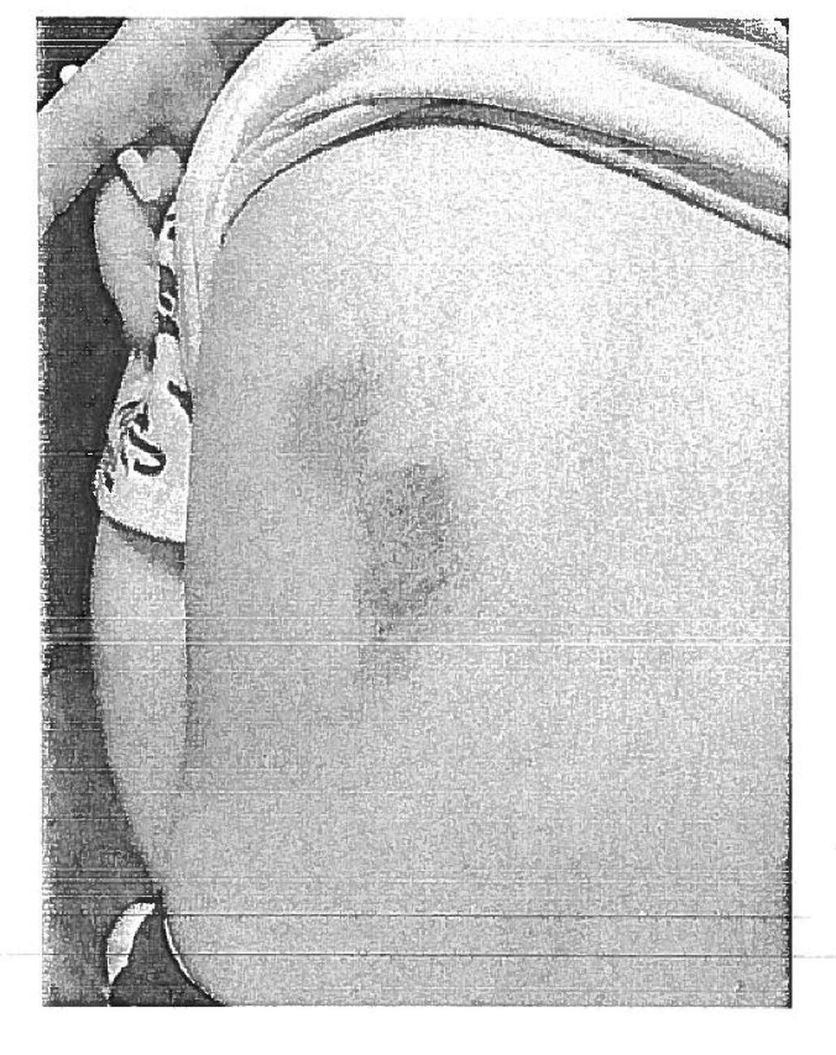 A boy suffered carpet burns across his back when he was dragged on the floor by a teacher in May 2024 at the Clark County Child Development Center in Winchester.