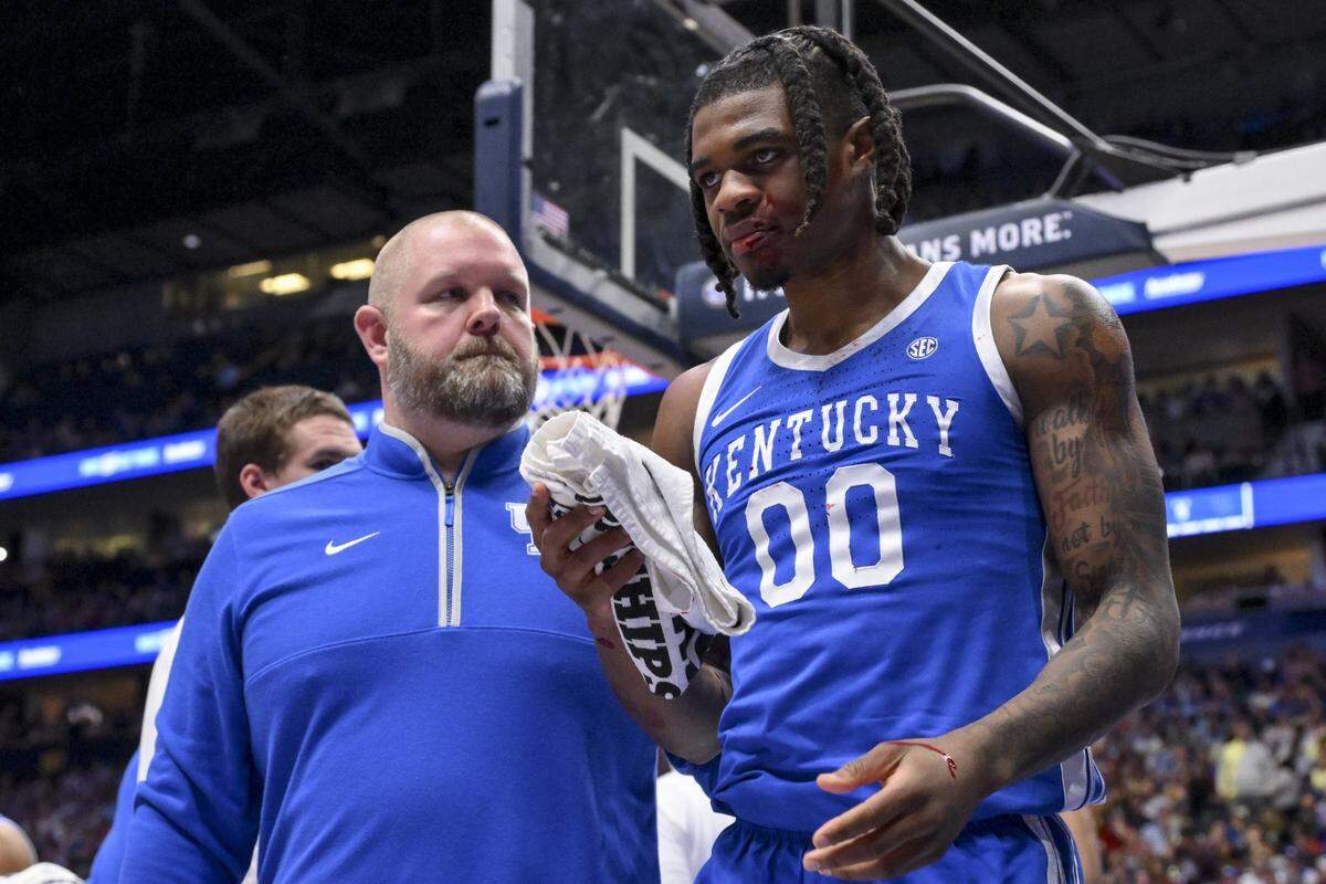 Mar 14, 2025; Nashville, TN, USA;  (EDITORS NOTE: blood) Kentucky Wildcats guard Otega Oweh (00) walks off the court with a trainer after getting hit in the mouth against the Alabama Crimson Tide during the first half at Bridgestone Arena. Mandatory Credit: Steve Roberts-Imagn Images