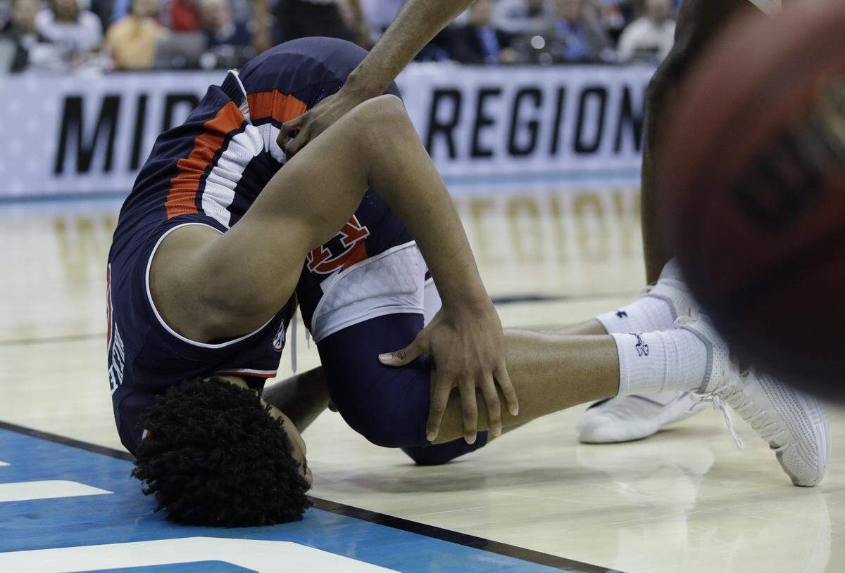 Auburn’s Chuma Okeke left the Tigers' 97-80 win over North Carolina on Friday night in the NCAA Tournament round of 16 with what was diagnosed Saturday as a torn ACL. Okeke had 20 points and 11 rebounds when he departed the game.