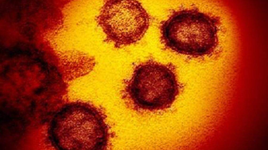 Coronavirus deaths top 60,000 in US. ‘We learned a lot of lessons here, painfully’