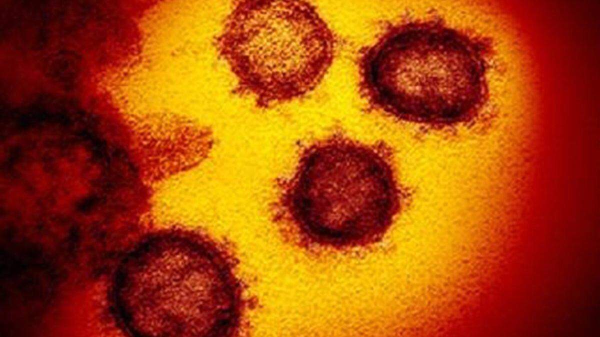This transmission electron microscope image shows SARS-CoV-2, also known as 2019-nCoV, the coronavirus virus that causes COVID-19. (National Institute of Allergy and Infectious Diseases Rocky Mountain Laboratories/TNS)