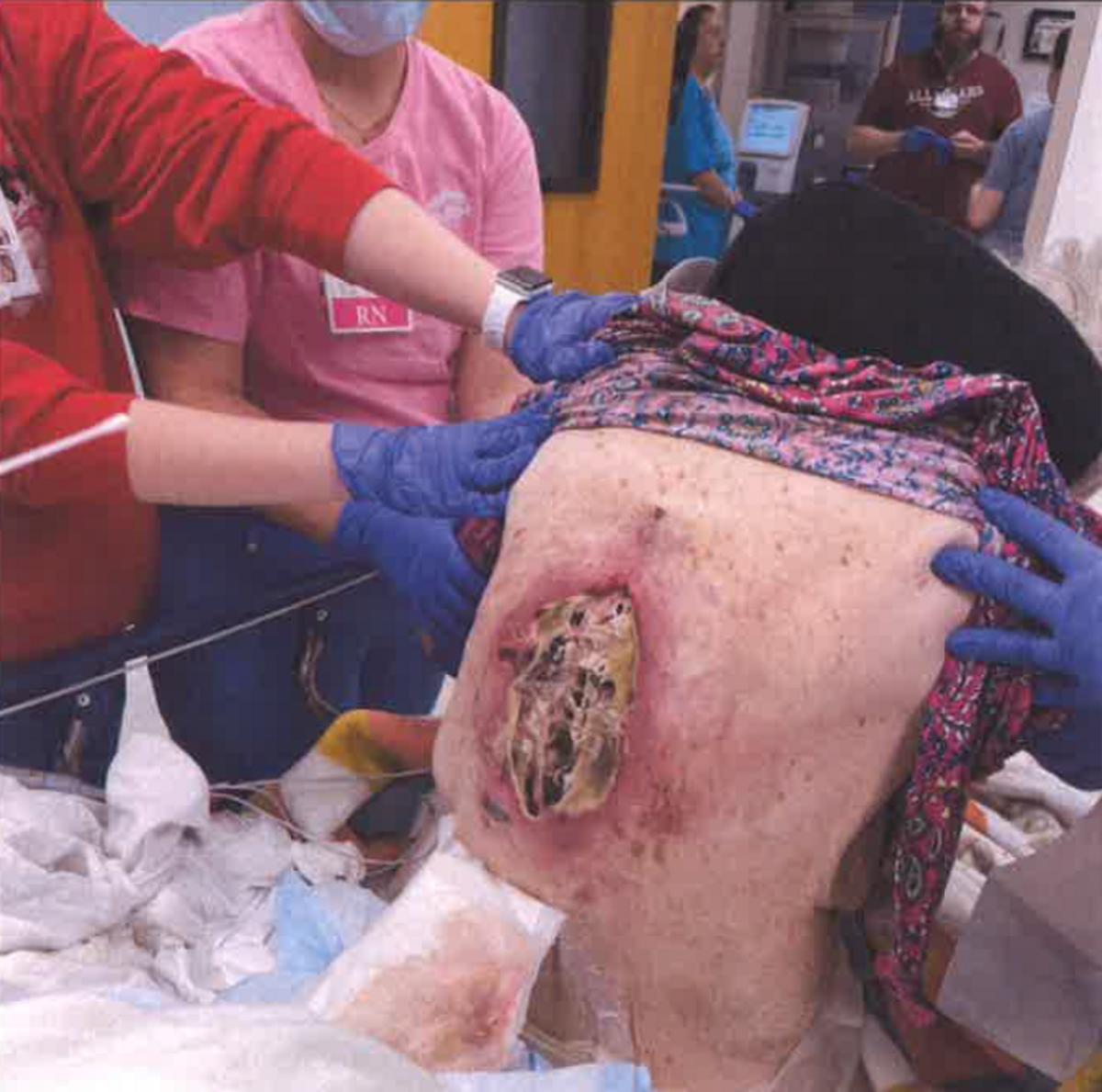By the time Ruth Reed was transferred from the nursing home to a hospital in November 2024, a pressure sore the size of a dinner plate had opened in her back. She would be dead three weeks later.