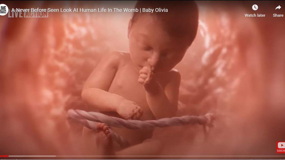 Students could see pregnancy video produced by anti-abortion group under advancing bill