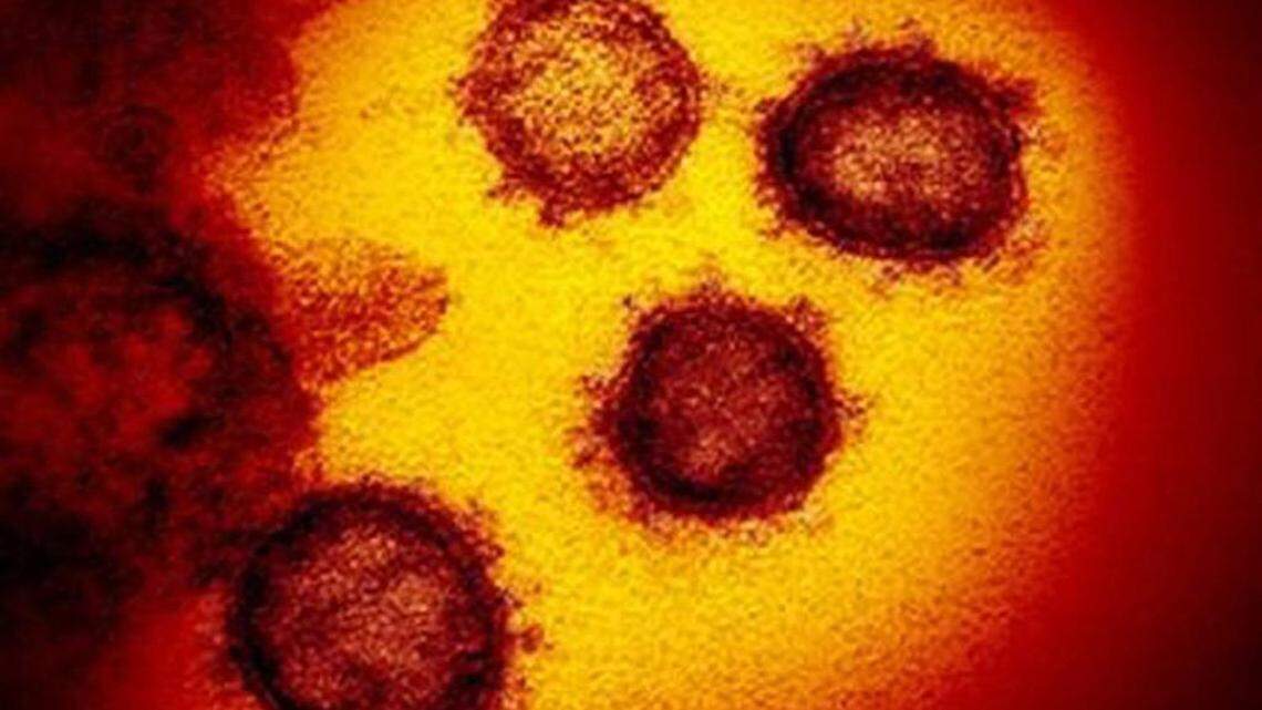 This transmission electron microscope image shows SARS-CoV-2, the virus that causes COVID-19, isolated from a patient in the U.S., emerging from the surface of cells cultured in the lab. (NIAID/TNS)