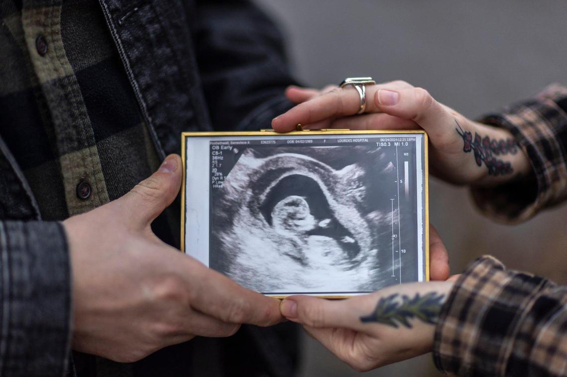 Stephen Montgomery and Genevieve Postlethwaite hold a image from an ultrasound in Murray, Ky., on Wednesday, Dec. 25, 2025. in July, Postlethwaite had a severe complication in her pregnancy that made it nonviable. But because of Kentucky’s abortion laws, they had to hastily go to Illinois to get an abortion