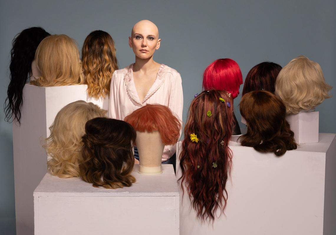 Singer Molly Tuttle, who has alopecia, surrounded by wigs. Tuttle said she has become more confident and that includes embracing her condition openly, in hopes of bring some positivity to other young people with hair loss.