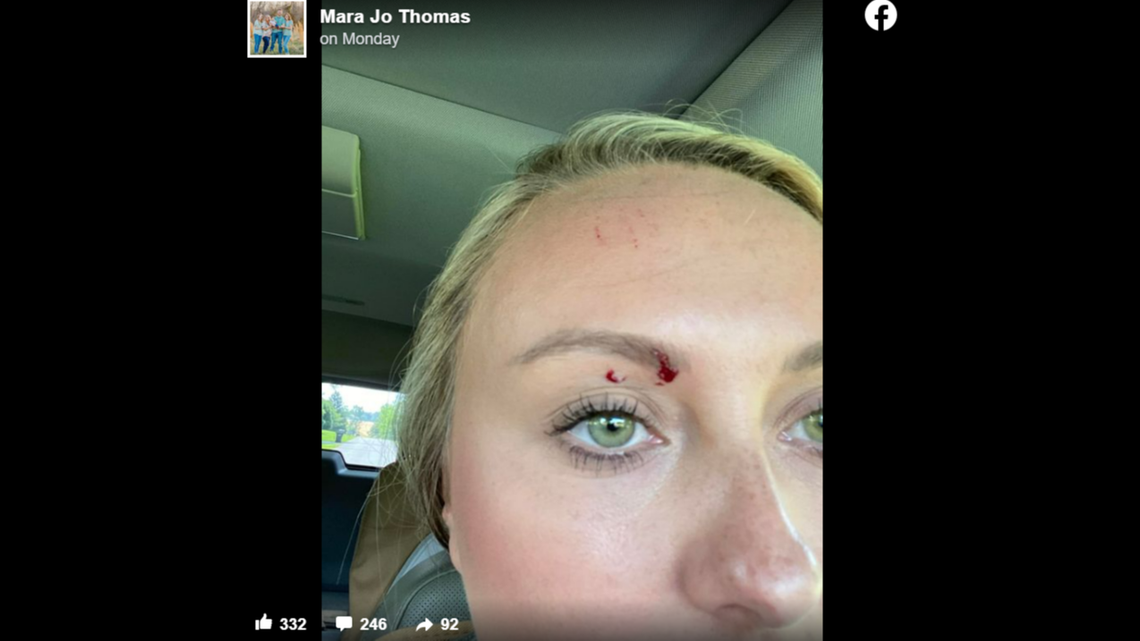 The snake nearly bit Mara Jo Thomas in the eye.