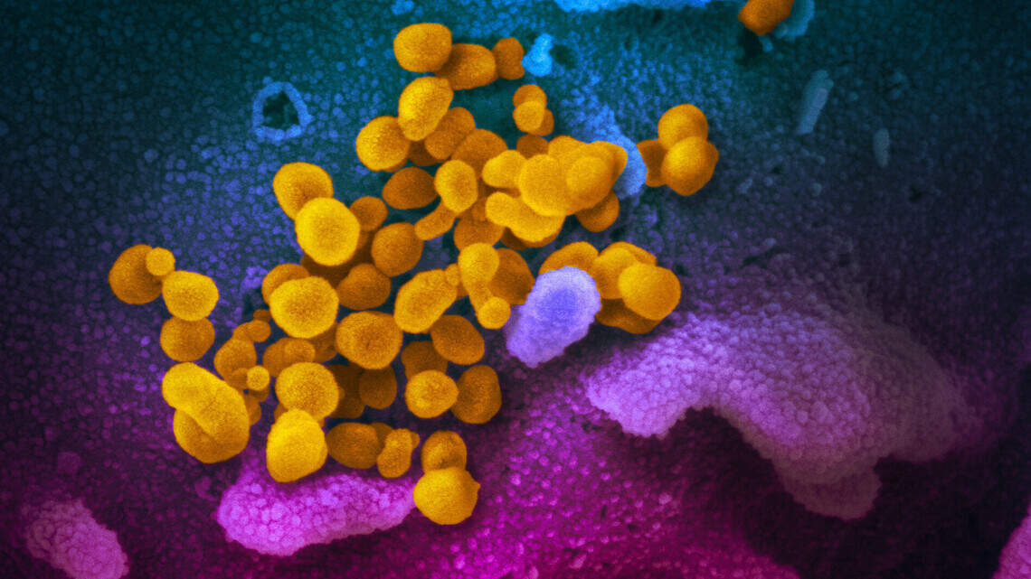 Coronavirus outbreak hits Central Kentucky nursing home for veterans