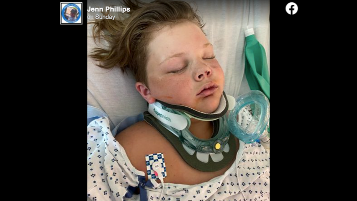 A 13-year-old suffered multiple neck and facial injuries after a tree fell on top of him during a friend’s birthday party.