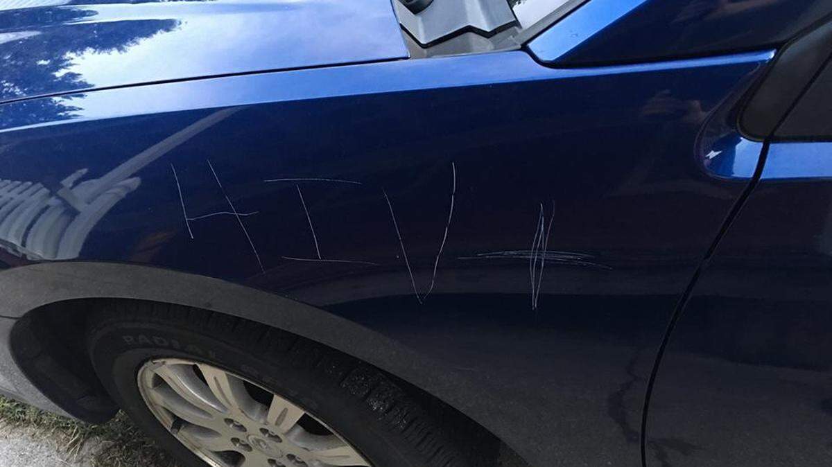 A man in downtown Lexington found “HIV+” and a homophobic slur keyed on his car last Wednesday. Photos of the vandalism were shared on social media, prompting frustration and support from the community.