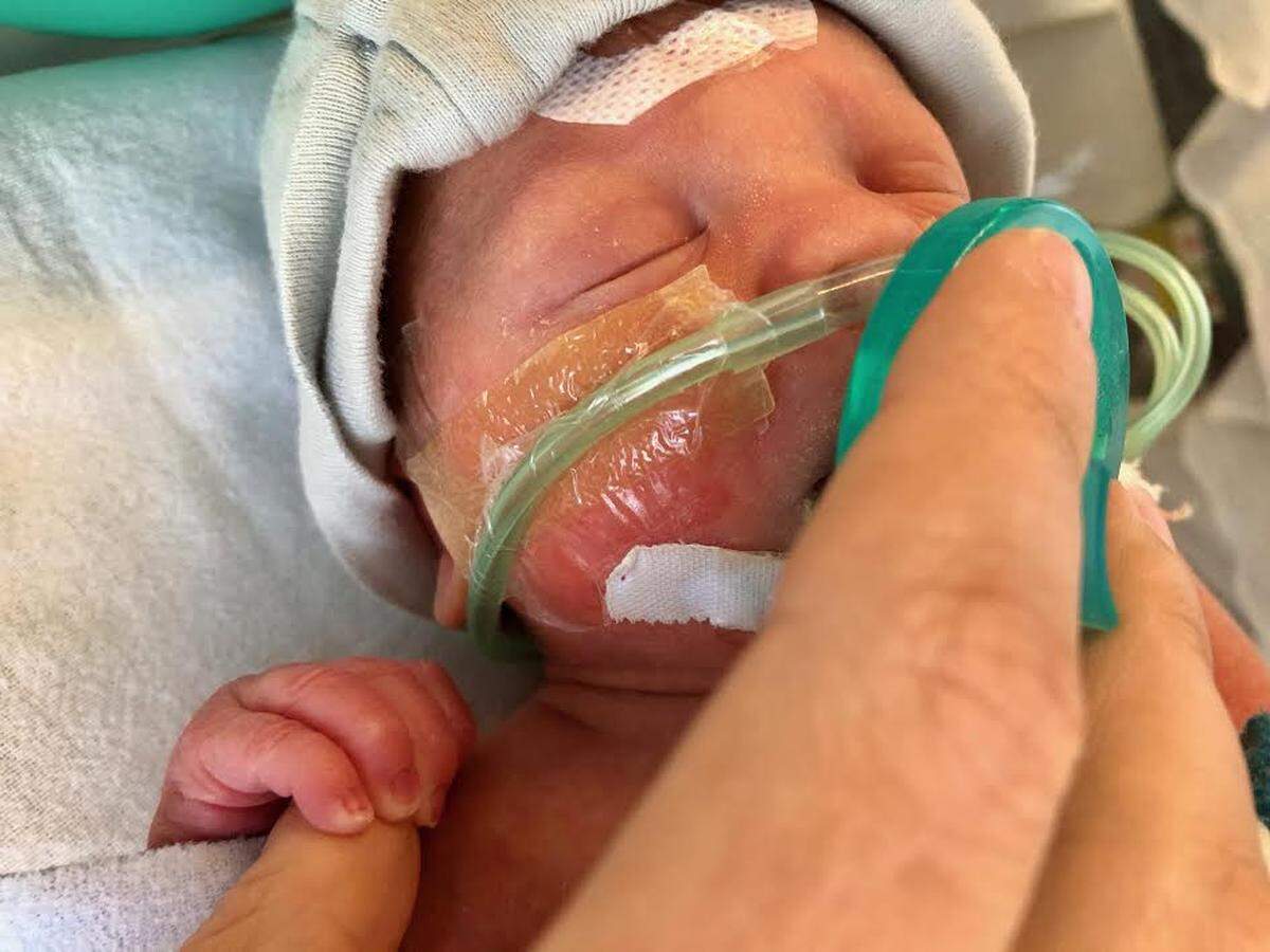 Noah Hall, who was born prematurely Saturday July 13. His father, Jordan Hall of Hindman, Kentucky, had many supporters nationwide as he chronicled on Facebook his son’s birth and his wife’s death from unexpected pregnancy complications.