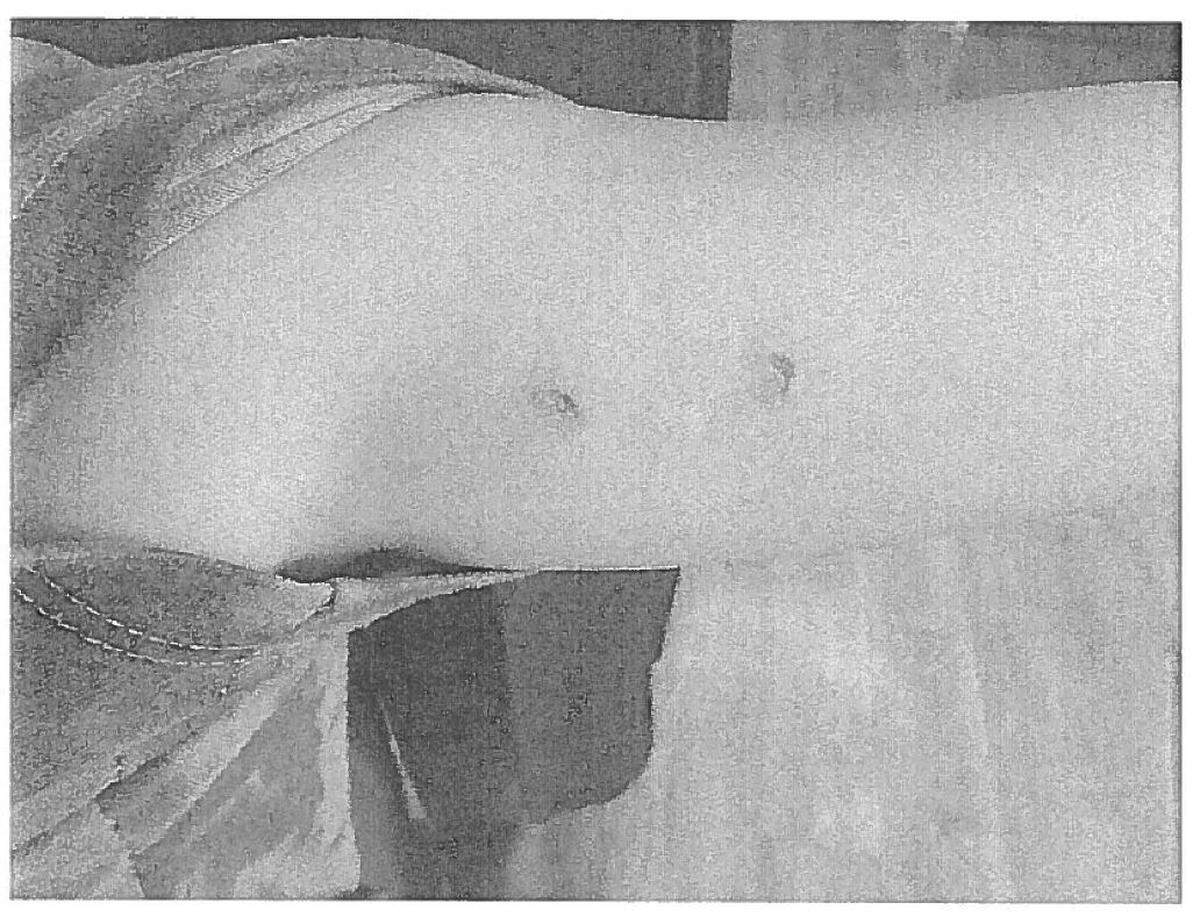 A boy’s arm had bloody wounds after a June 2024 incident at Clark County Child Development Center in Winchester.