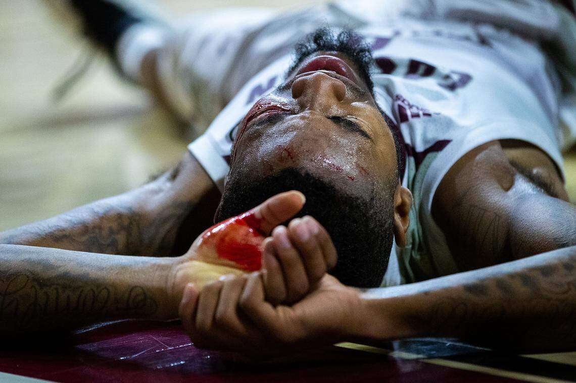 Eastern Kentucky Colonels guard Russhard Cruickshank (0) lies down in pain after being cut under his left eye during the Western Kentucky University vs. Eastern Kentucky University men’s basketball game at Alumni Coliseum in Richmond, Kentucky Friday, Nov. 15, 2019. WKU won 79-71.