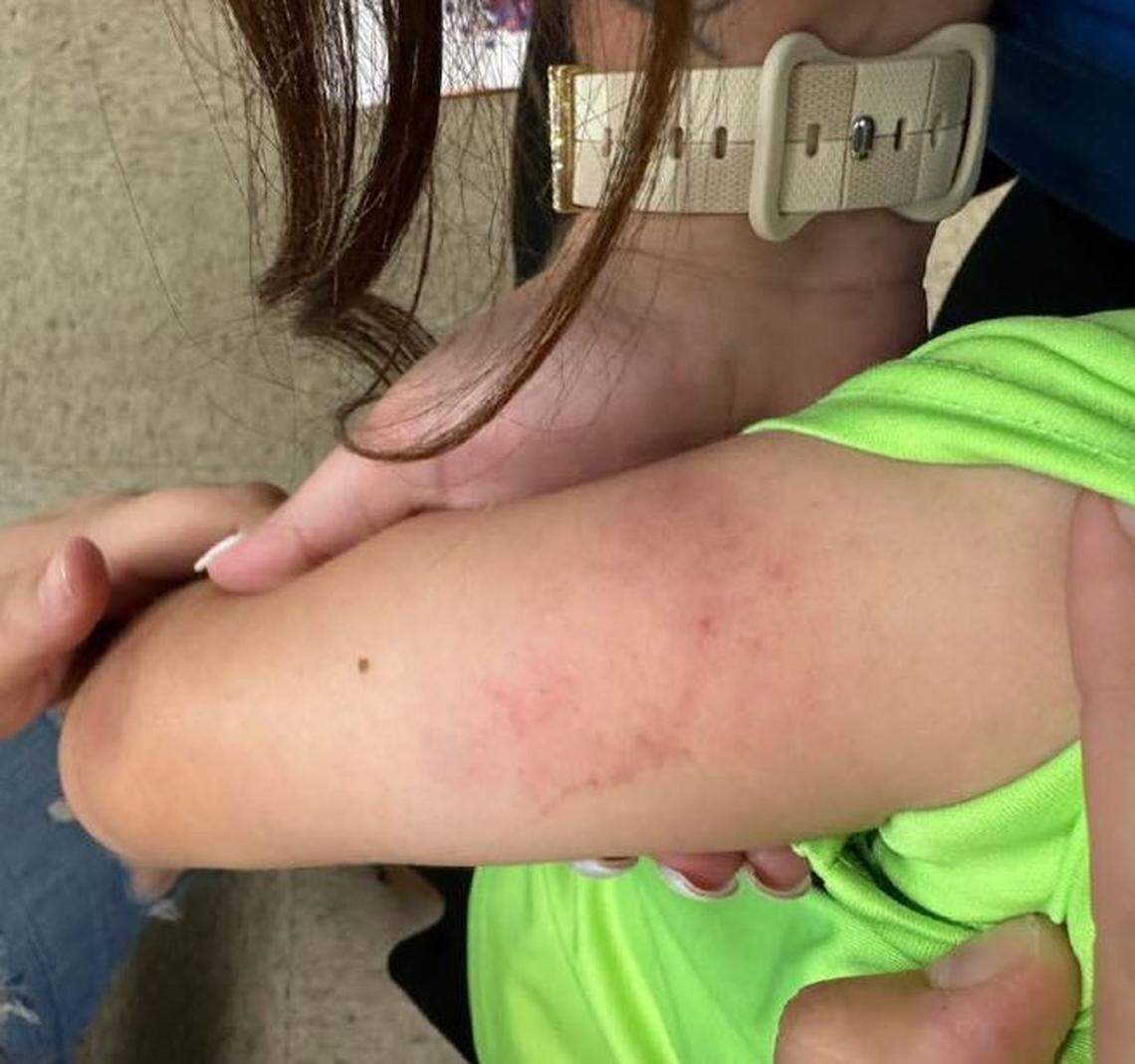 State investigators said a daycare employee in Owensboro roughly grabbed a misbehaving boy by the upper arms on June 20, 2024, and carried him out of the room, leaving bruises on his arms.