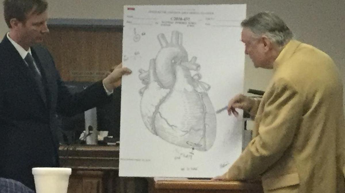 Prosecutor John Hayne, left, and Dr. John Hunsaker III, right, retired associate chief medical examiner for Kentucky, examine a chart depicting a stab wound to Maxwell Pomeroy Jr. Hunsaker testified Monday in the trial of Melinda Turner, who is charged with murder in Pomeroy’s death.
