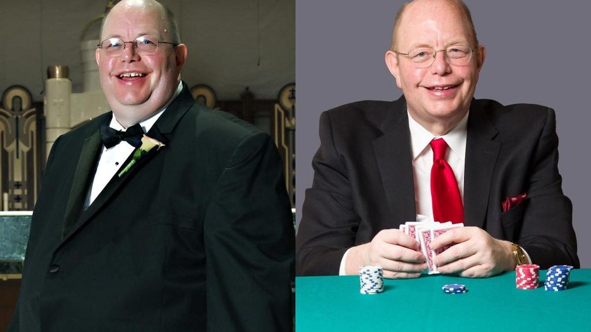 Author Don McNay before and after weight-loss surgery that, along with a better diet and regular exercise, helped him drop 115 pounds.