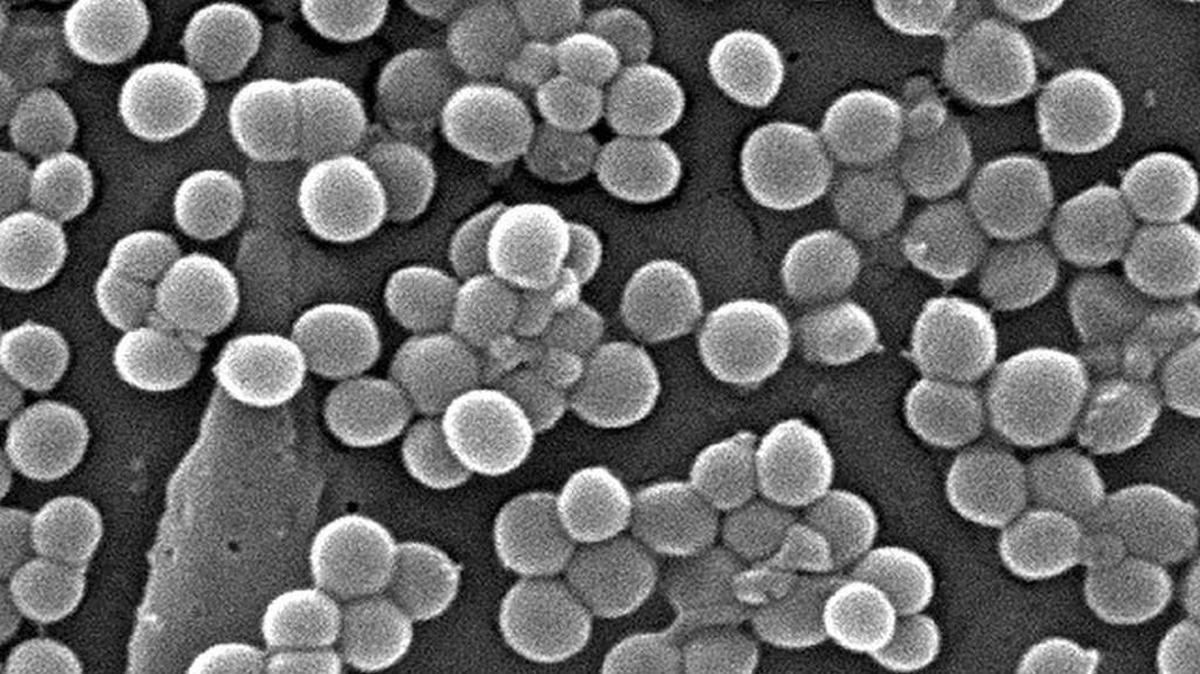 Clumps of MRSA (Methicillin-Resistant Staphylococcus aureus) bacteria in a CDC electron micrograph photo.