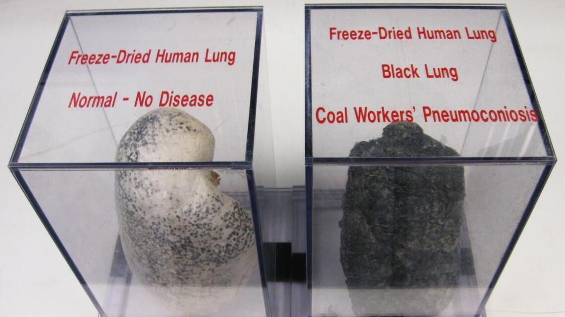 How do so many coal companies get to walk away from their obligations with bankruptcy? | Opinion