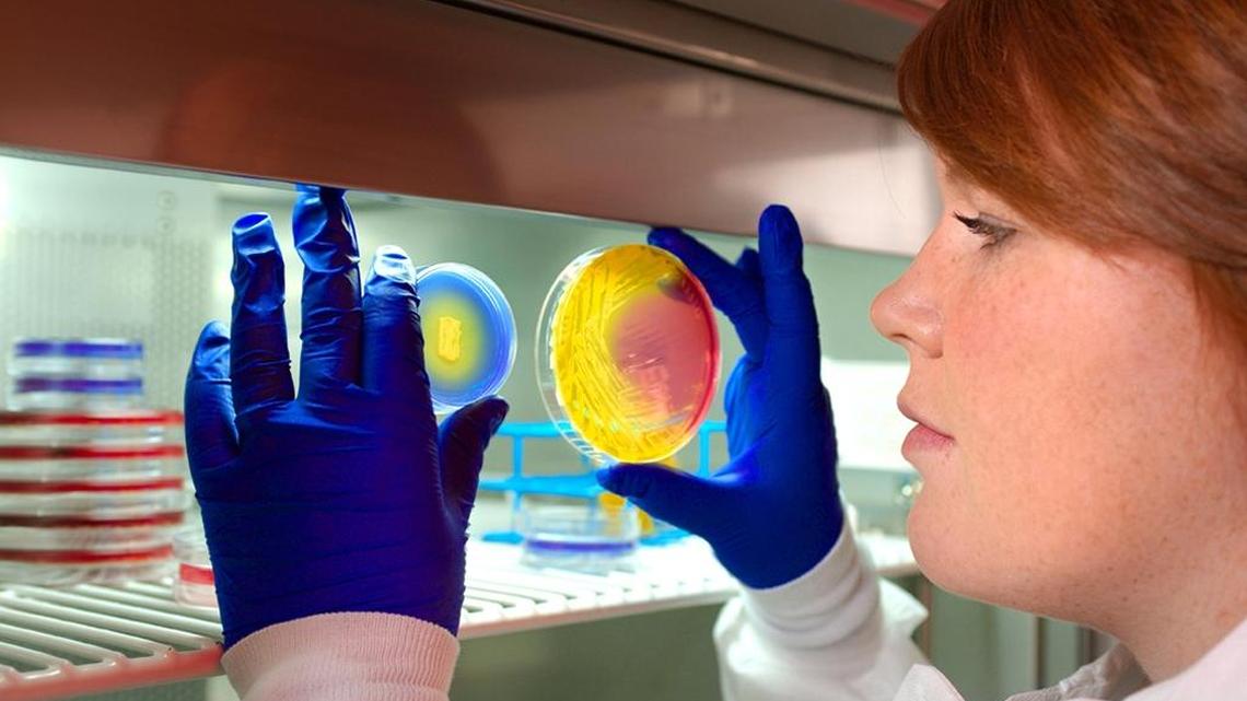 A microbiologist examines MRSA plates.